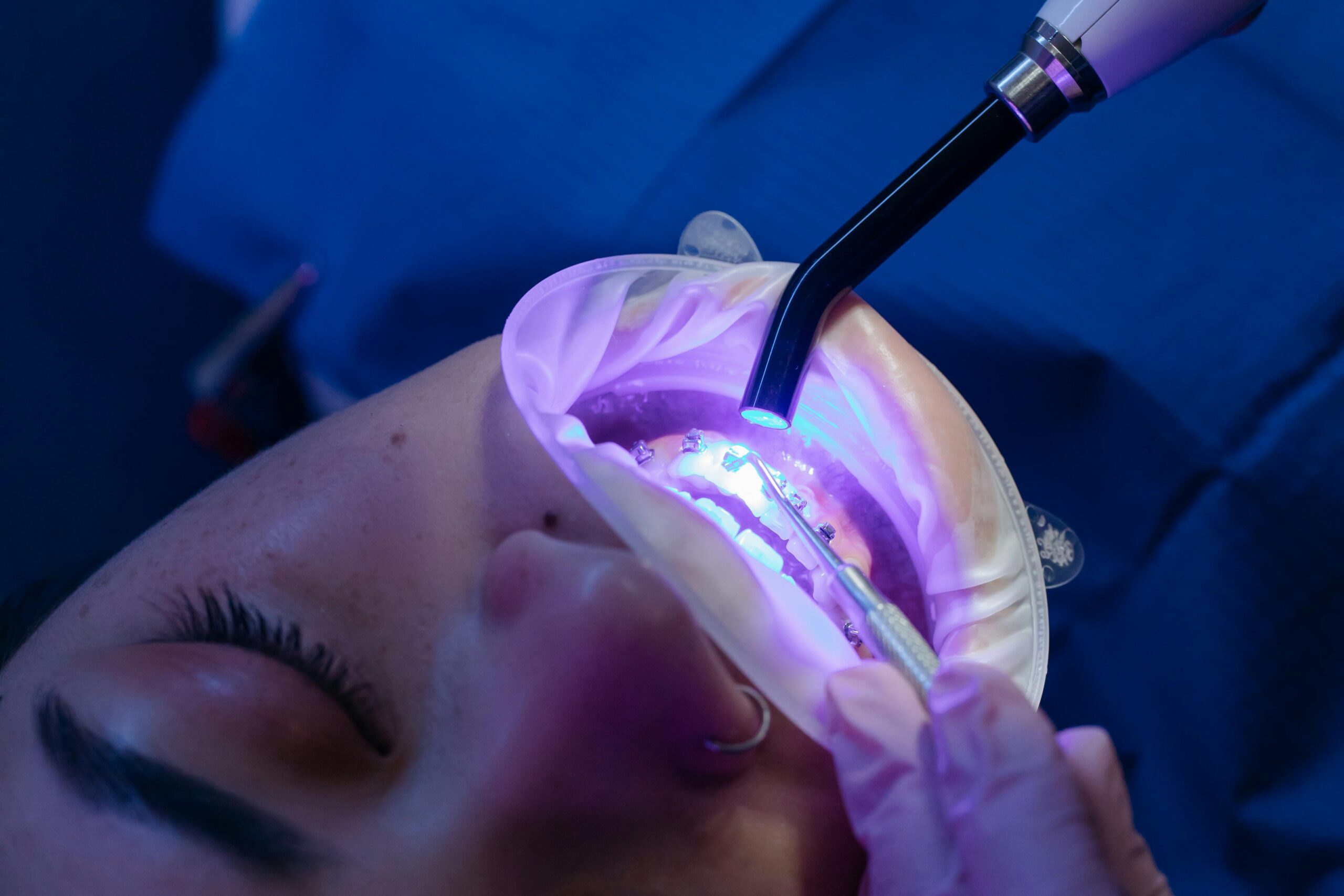 Cosmetic Dentistry