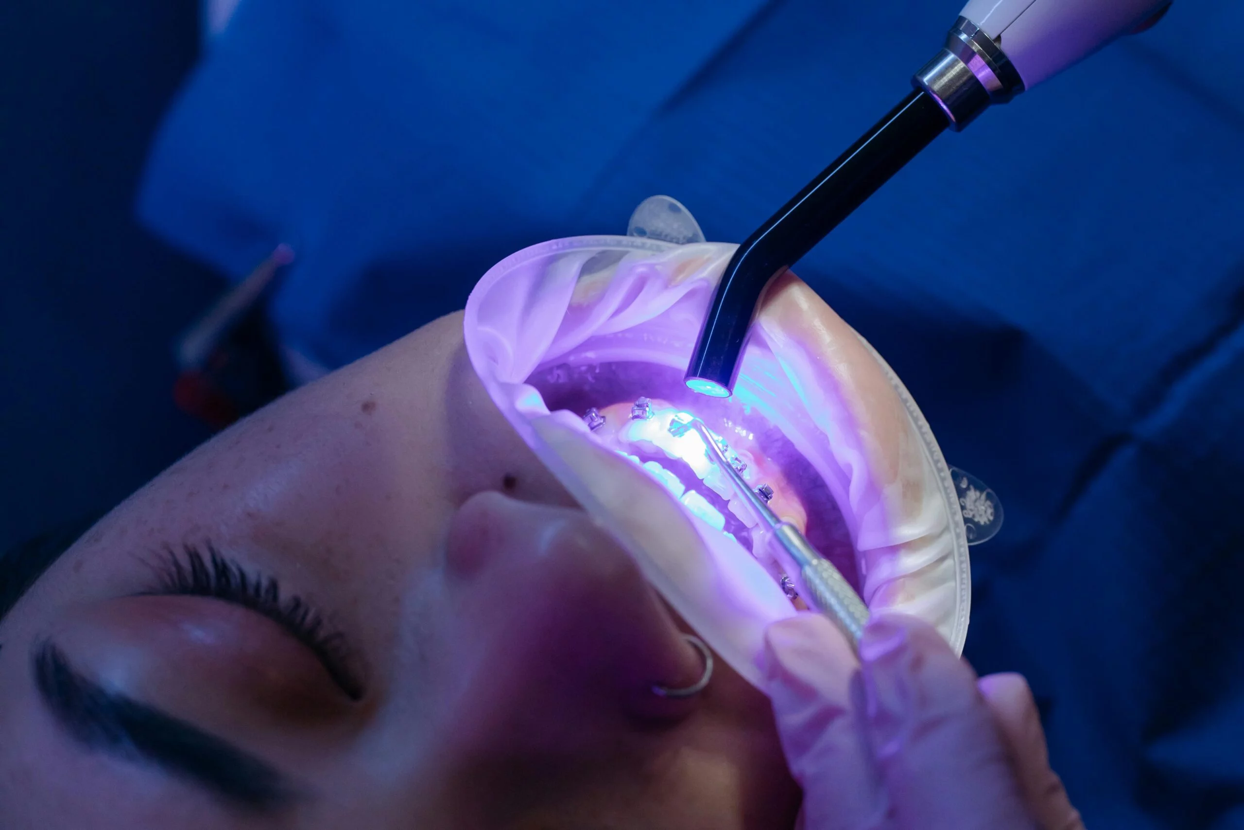 Cosmetic Dentistry